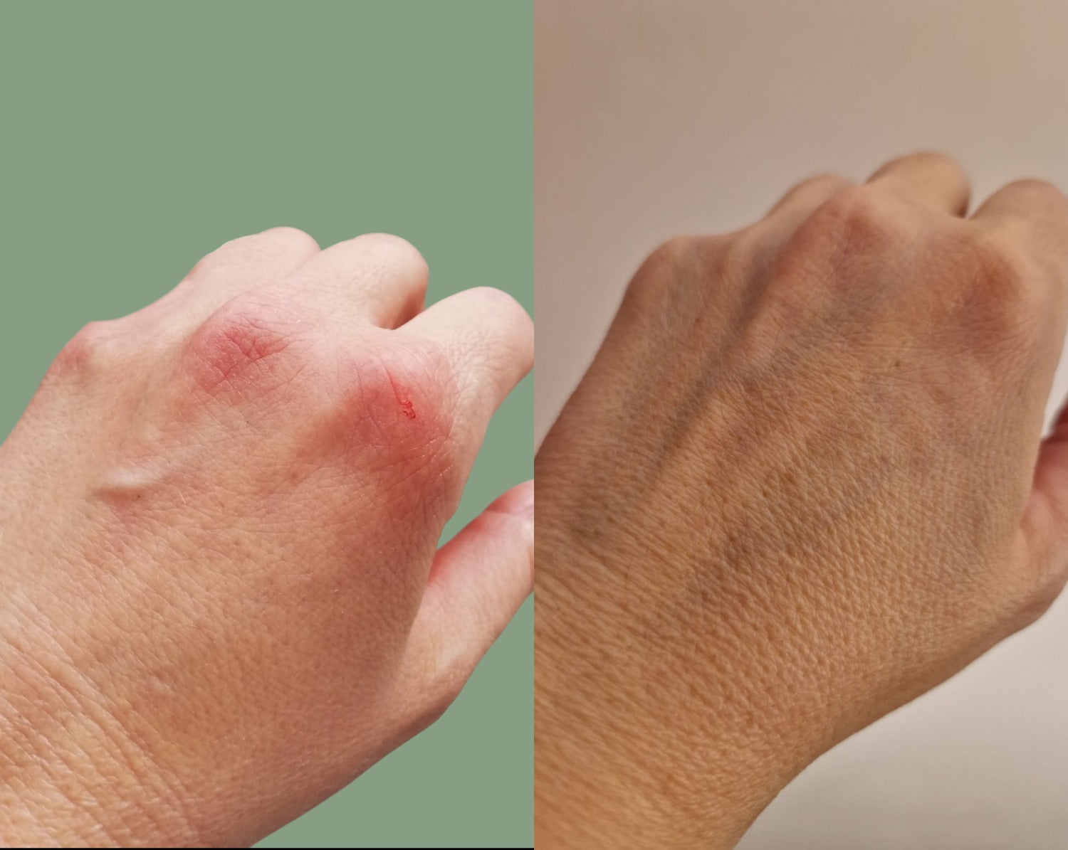 Piele sensibilă? MyBee este alegerea potrivită pentru tine