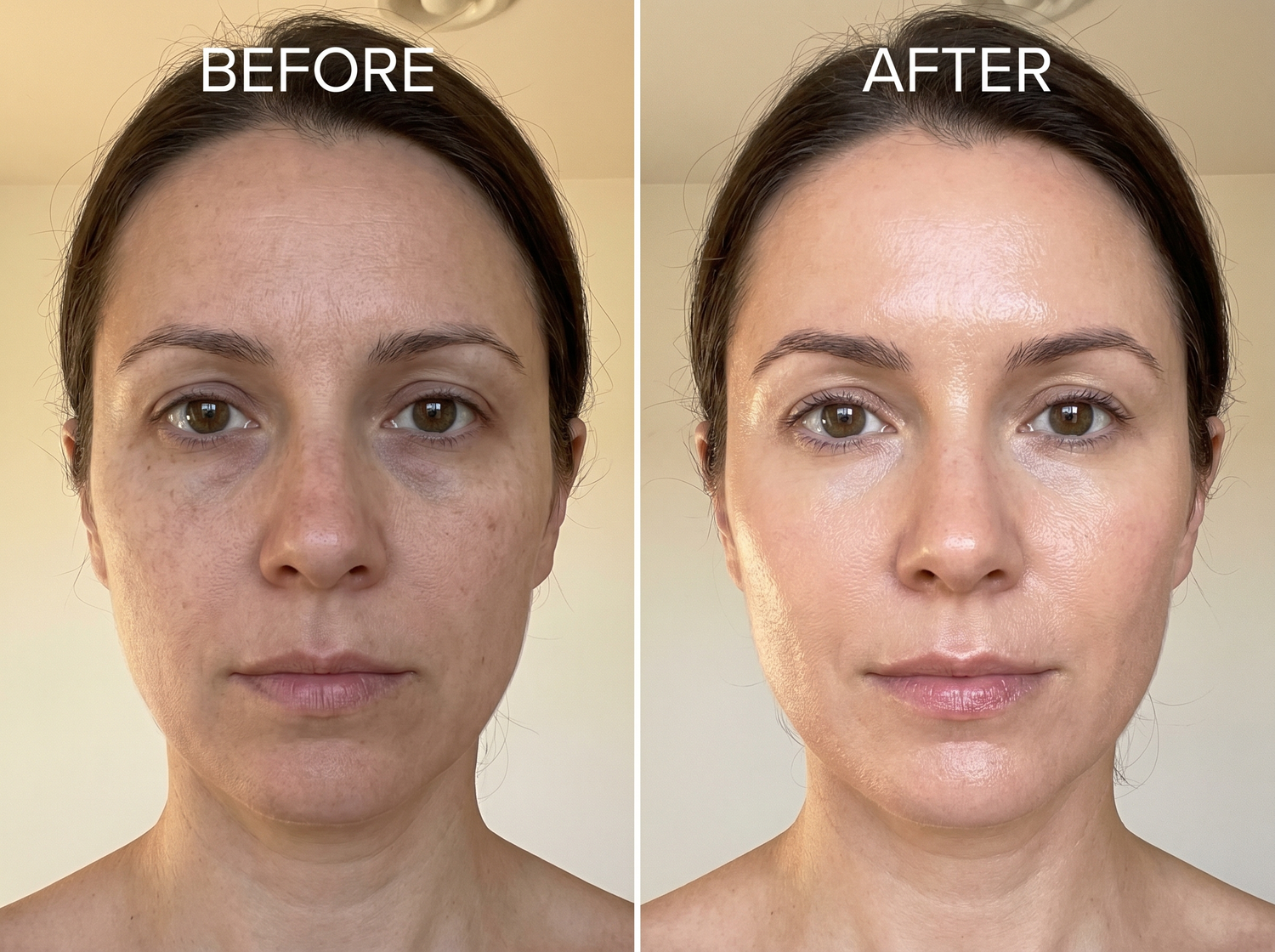 Mihaela D before after
